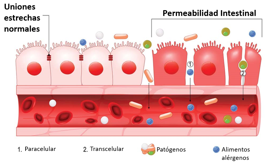 intestino comprendiendo el sindrome del intestino permeable