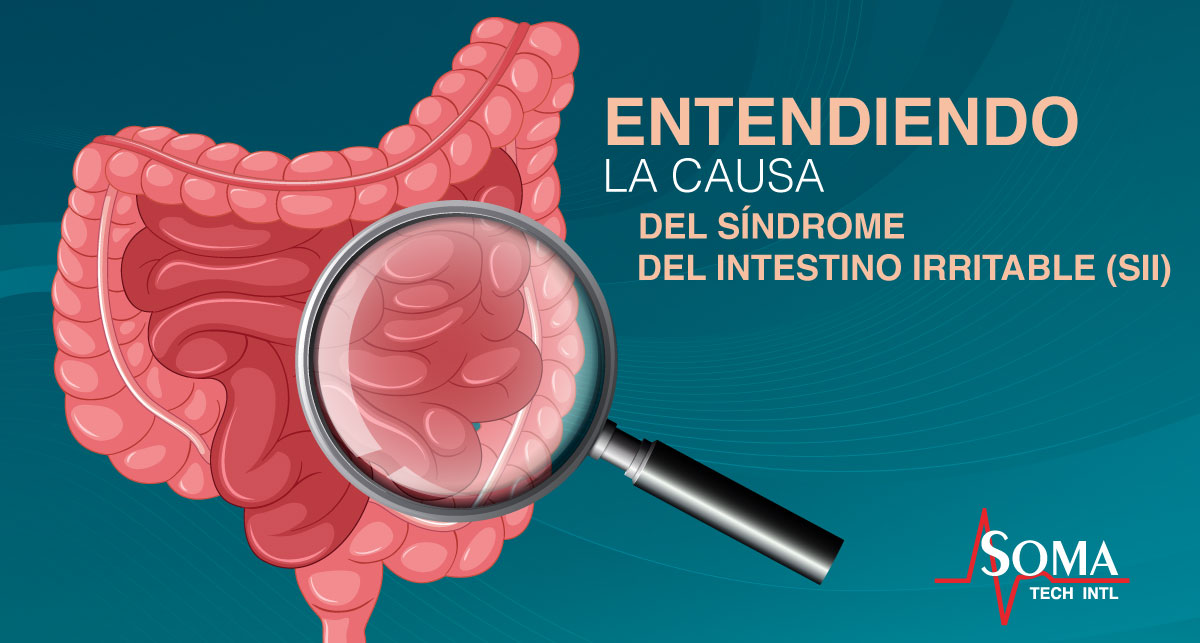 por que el sindrome del intestino irritable afecta mas a mujeres