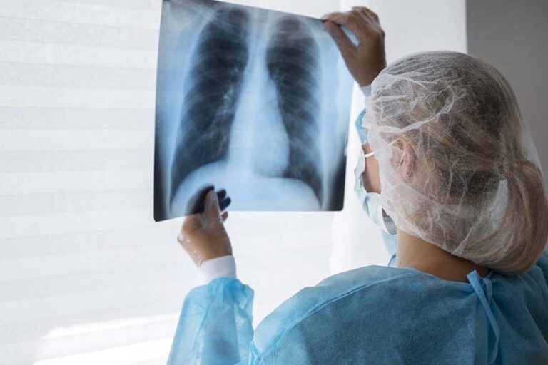 Tuberculosis: Por qué su aumento en EE. UU. tras 30 años